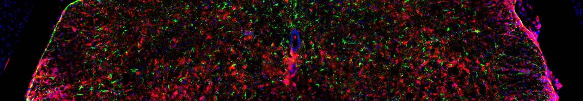 LISC 400 Neuro-Immune Interactions in Health & Disease