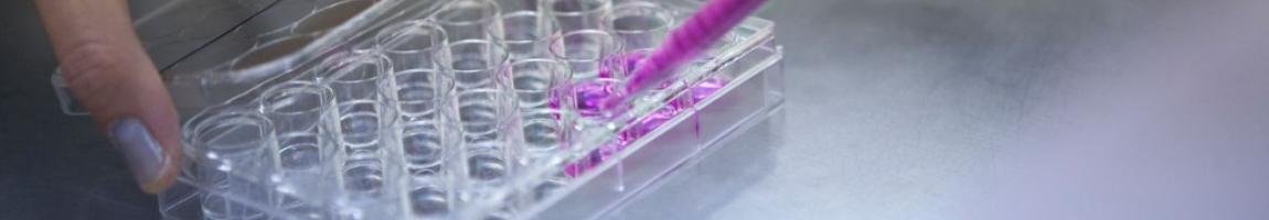 MICR 270 Infection, Immunity, and Inflammation